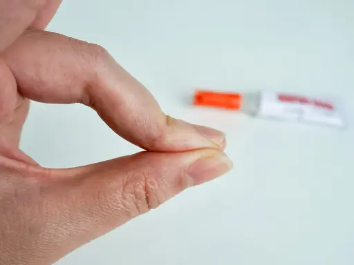 Fingerkuppen kleben zusammen. Ein Röhrchen mit debonder liegt unscharf im Hintergrund.